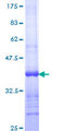 CCL2 / MCP1 Protein - 12.5% SDS-PAGE Stained with Coomassie Blue.
