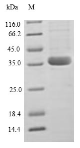 CCL2 / MCP1 Protein - (Tris-Glycine gel) Discontinuous SDS-PAGE (reduced) with 5% enrichment gel and 15% separation gel.