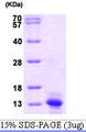CCL2 / MCP1 Protein