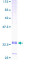 CCL20 / MIP-3-Alpha Protein - 12.5% SDS-PAGE of human CCL20 stained with Coomassie Blue