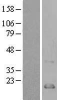 CCL21 / SLC Protein - Western validation with an anti-DDK antibody * L: Control HEK293 lysate R: Over-expression lysate