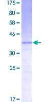 CCL21 / SLC Protein - 12.5% SDS-PAGE of human CCL21 stained with Coomassie Blue