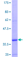 CCL22 / MDC Protein - 12.5% SDS-PAGE of human CCL22 stained with Coomassie Blue