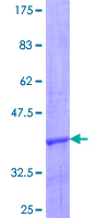 CCL24 / Eotaxin 2 Protein - 12.5% SDS-PAGE of human CCL24 stained with Coomassie Blue