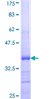 CCL25 / TECK Protein - 12.5% SDS-PAGE Stained with Coomassie Blue.