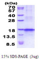 CCL25 / TECK Protein