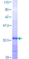 CCL26 / Eotaxin 3 Protein - 12.5% SDS-PAGE Stained with Coomassie Blue.