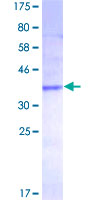CCL27 Protein - 12.5% SDS-PAGE of human CCL27 stained with Coomassie Blue