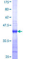 CCL28 / MEC Protein - 12.5% SDS-PAGE Stained with Coomassie Blue.