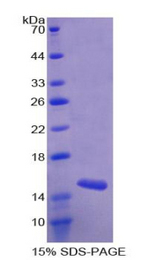CCL28 / MEC Protein - Recombinant Mucosae Associated Epithelia Chemokine By SDS-PAGE