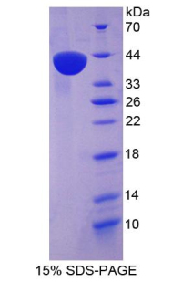 CCL3 / MIP-1-Alpha Protein - Recombinant Macrophage Inflammatory Protein 1 Alpha By SDS-PAGE