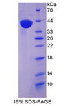 CCL3 / MIP-1-Alpha Protein - Recombinant Macrophage Inflammatory Protein 1 Alpha By SDS-PAGE