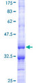 CCL4 / MIP-1 Beta Protein - 12.5% SDS-PAGE Stained with Coomassie Blue.