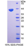CCL4 / MIP-1 Beta Protein - Recombinant Macrophage Inflammatory Protein 1 Beta By SDS-PAGE