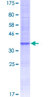 CCL4L1 Protein - 12.5% SDS-PAGE of human CCL4L1 stained with Coomassie Blue