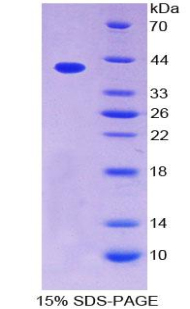 CCL4L1 Protein - Recombinant Chemokine C-C-Motif Ligand 4 Like Protein 1 By SDS-PAGE