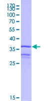 CCL4L2 Protein - 12.5% SDS-PAGE Stained with Coomassie Blue.