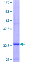 CCL5 / RANTES Protein - 12.5% SDS-PAGE of human CCL5 stained with Coomassie Blue