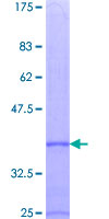 CCL7 / MCP3 Protein - 12.5% SDS-PAGE of human CCL7 stained with Coomassie Blue