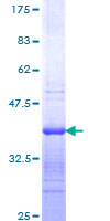 CCL7 / MCP3 Protein - 12.5% SDS-PAGE Stained with Coomassie Blue.