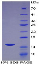 CCL8 / MCP2 Protein - Recombinant Monocyte Chemotactic Protein 2 By SDS-PAGE