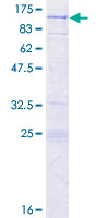 CCM1 / KRIT1 Protein - 12.5% SDS-PAGE of human KRIT1 stained with Coomassie Blue