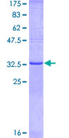 CCM1 / KRIT1 Protein - 12.5% SDS-PAGE Stained with Coomassie Blue.