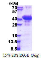 CCM2 / Malcavernin Protein