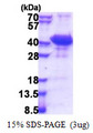 CCM2 / Malcavernin Protein