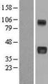 CCN3 / NOV Protein - Western validation with an anti-DDK antibody * L: Control HEK293 lysate R: Over-expression lysate