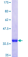 CCN3 / NOV Protein - 12.5% SDS-PAGE Stained with Coomassie Blue.