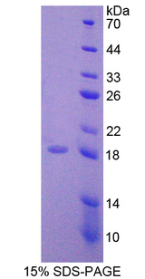 CCN4 / WISP1 Protein - Recombinant  WNT1 Inducible Signaling Pathway Protein 1 By SDS-PAGE