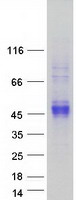 CCN4 / WISP1 Protein - Purified recombinant protein WISP1 was analyzed by SDS-PAGE gel and Coomassie Blue Staining