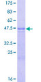 CCN5 Protein - 12.5% SDS-PAGE of human WISP2 stained with Coomassie Blue