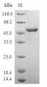 CCN5 Protein - (Tris-Glycine gel) Discontinuous SDS-PAGE (reduced) with 5% enrichment gel and 15% separation gel.
