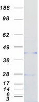 CCN5 Protein - Purified recombinant protein WISP2 was analyzed by SDS-PAGE gel and Coomassie Blue Staining
