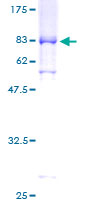 CCNA1 / Cyclin A1 Protein - 12.5% SDS-PAGE of human CCNA1 stained with Coomassie Blue
