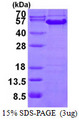 CCNA2 / Cyclin A2 Protein