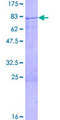CCNB1 / Cyclin B1 Protein - 12.5% SDS-PAGE of human CCNB1 stained with Coomassie Blue