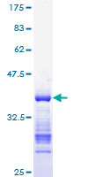 CCNB1 / Cyclin B1 Protein - 12.5% SDS-PAGE Stained with Coomassie Blue.