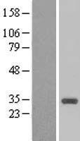 CCNB1IP1 Protein - Western validation with an anti-DDK antibody * L: Control HEK293 lysate R: Over-expression lysate