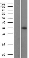 CCNB1IP1 Protein - Western validation with an anti-DDK antibody * L: Control HEK293 lysate R: Over-expression lysate