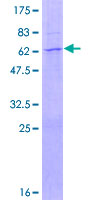 CCNB1IP1 Protein - 12.5% SDS-PAGE of human CCNB1IP1 stained with Coomassie Blue