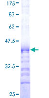 CCNB1IP1 Protein - 12.5% SDS-PAGE Stained with Coomassie Blue.