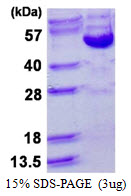CCNB2 / Cyclin B2 Protein