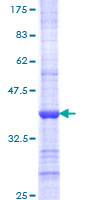 CCNB3 / Cyclin B3 Protein - 12.5% SDS-PAGE Stained with Coomassie Blue.