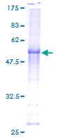 CCNC / Cyclin C Protein - 12.5% SDS-PAGE of human CCNC stained with Coomassie Blue