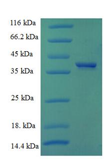 CCND1 / Cyclin D1 Protein