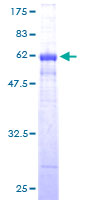 CCND1 / Cyclin D1 Protein - 12.5% SDS-PAGE of human CCND1 stained with Coomassie Blue