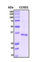 CCND1 / Cyclin D1 Protein